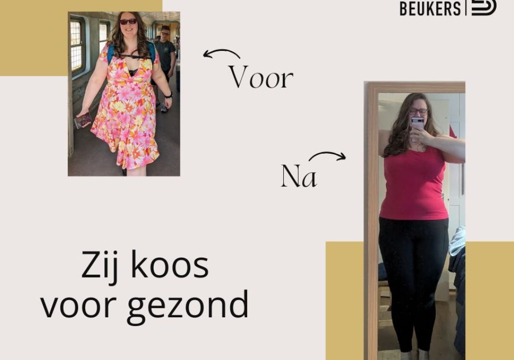 6749c83c90b40da935c381fc_voor-na-resultaat-Lot-Beukers-2